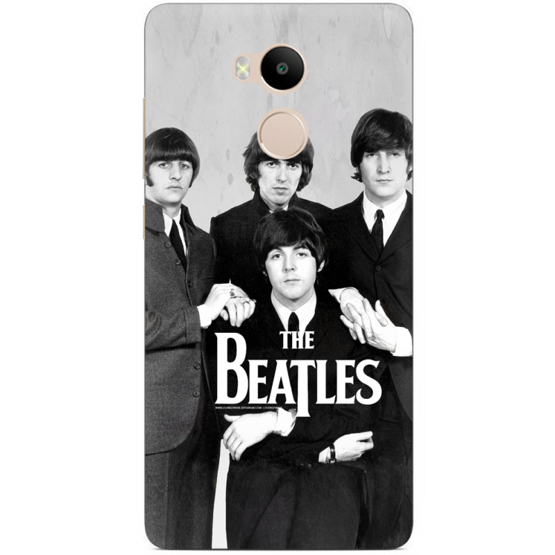 Чехол Uprint Xiaomi Redmi 4 Prime 