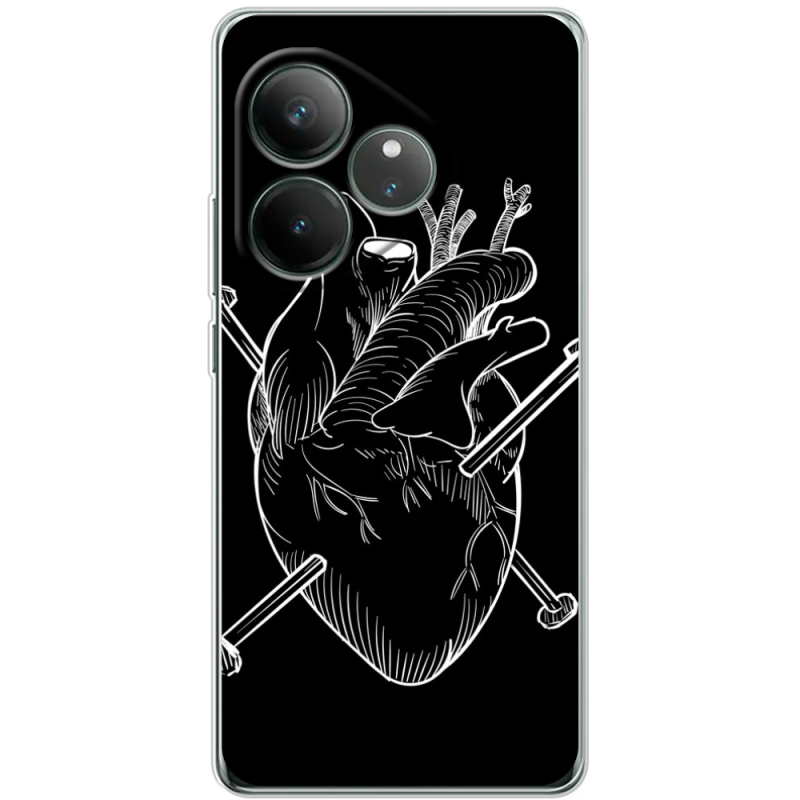 Чохол BoxFace Realme GT 6 