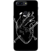 Чехол U-print OnePlus 5T 