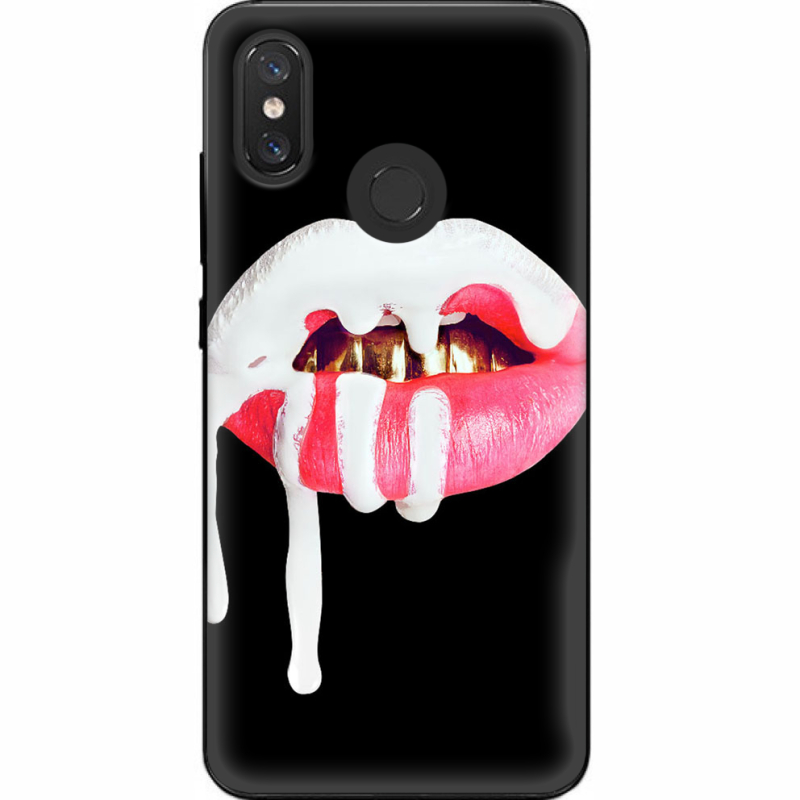 Чехол U-print Xiaomi Mi 8 