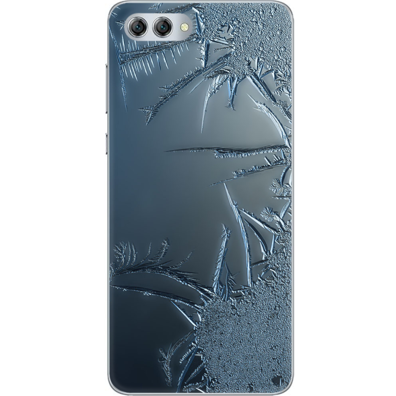 Чехол U-print Huawei Nova 2s 