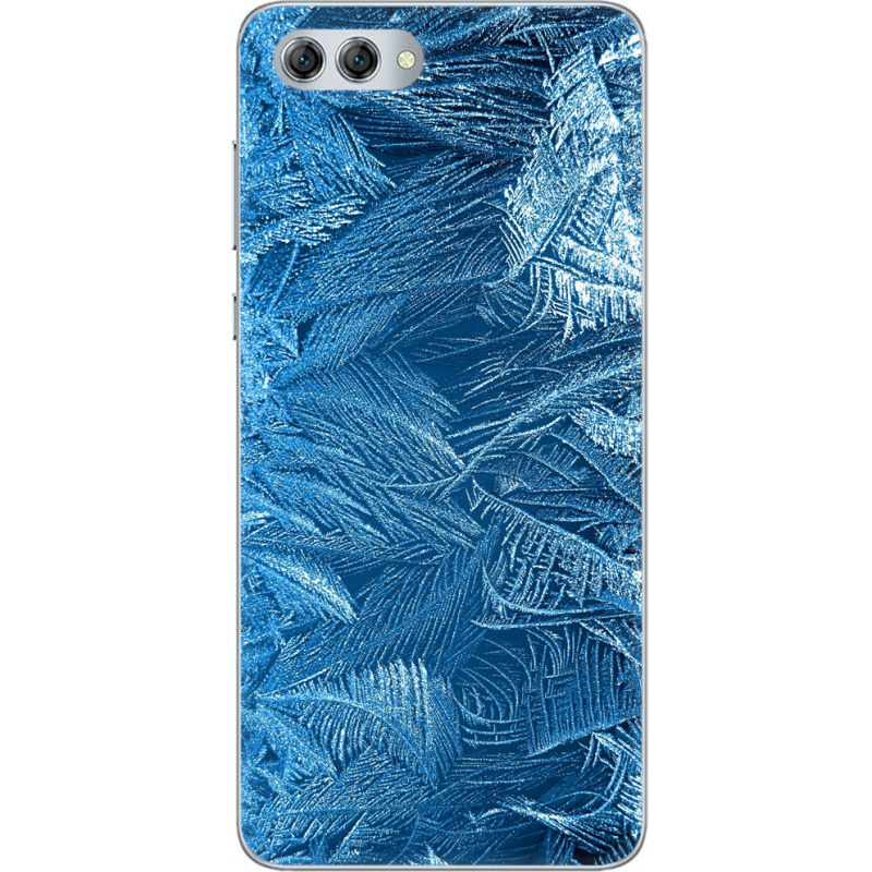 Чехол U-print Huawei Nova 2s 