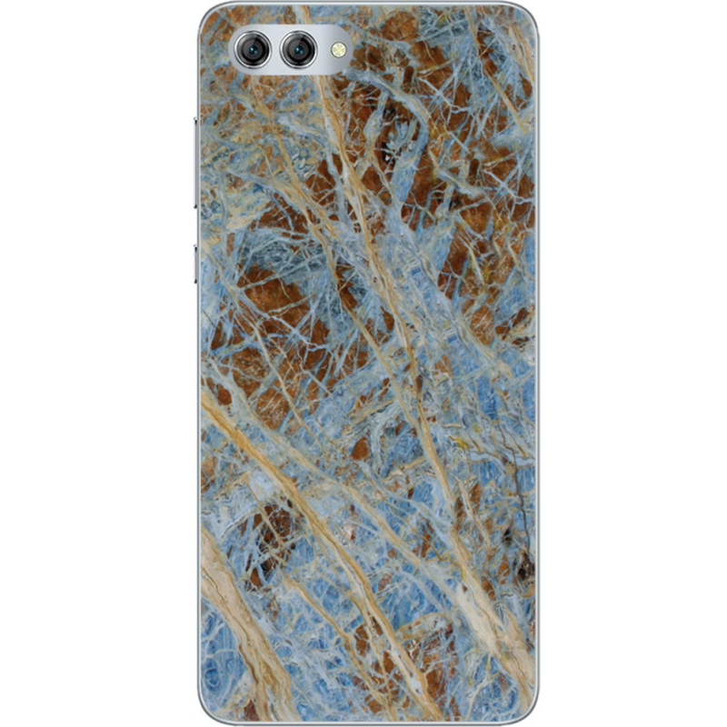 Чехол U-print Huawei Nova 2s 