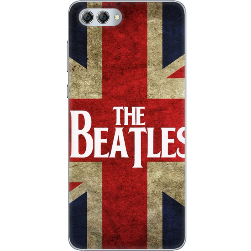 Чехол U-print Huawei Nova 2s 