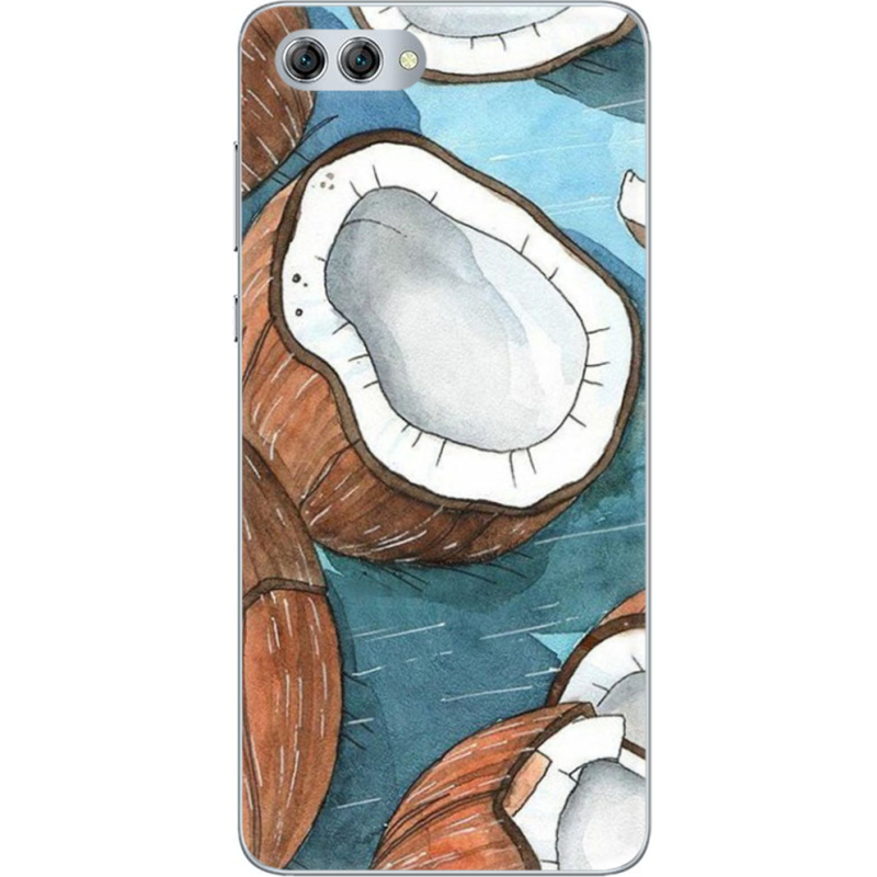 Чехол U-print Huawei Nova 2s 