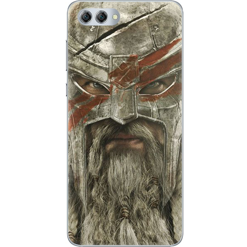 Чехол U-print Huawei Nova 2s 