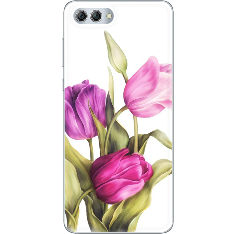 Чехол U-print Huawei Nova 2s 