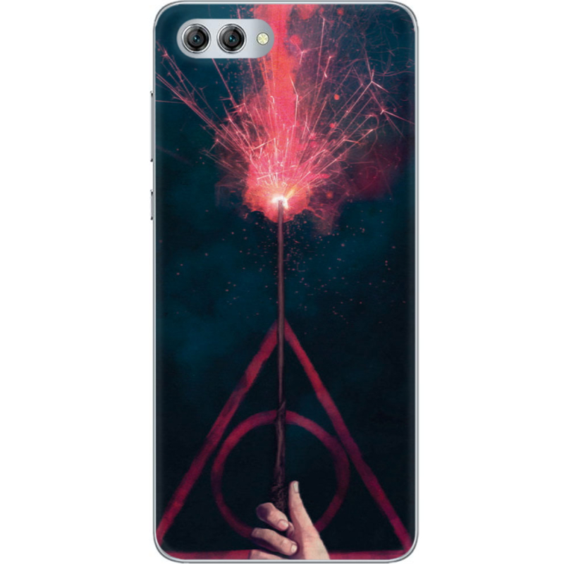 Чехол U-print Huawei Nova 2s 