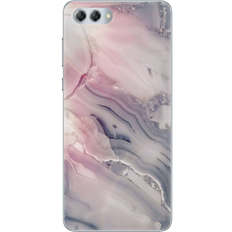 Чехол U-print Huawei Nova 2s 