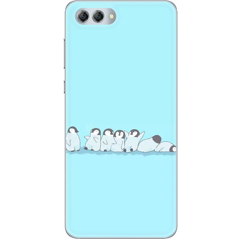 Чехол U-print Huawei Nova 2s 