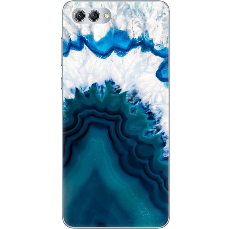 Чехол U-print Huawei Nova 2s 