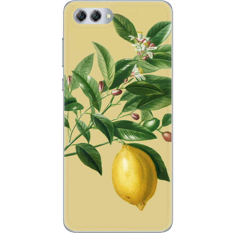 Чехол U-print Huawei Nova 2s 