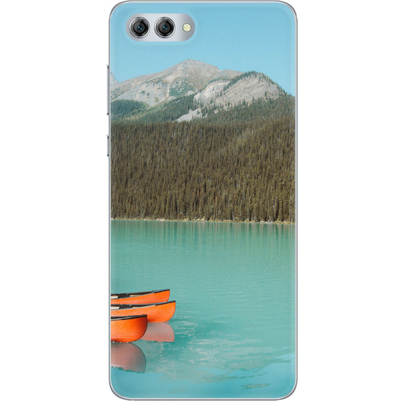 Чехол U-print Huawei Nova 2s 