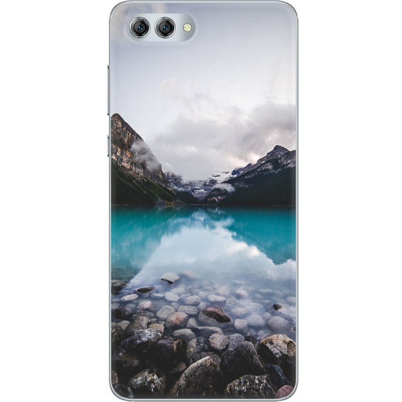 Чехол U-print Huawei Nova 2s 