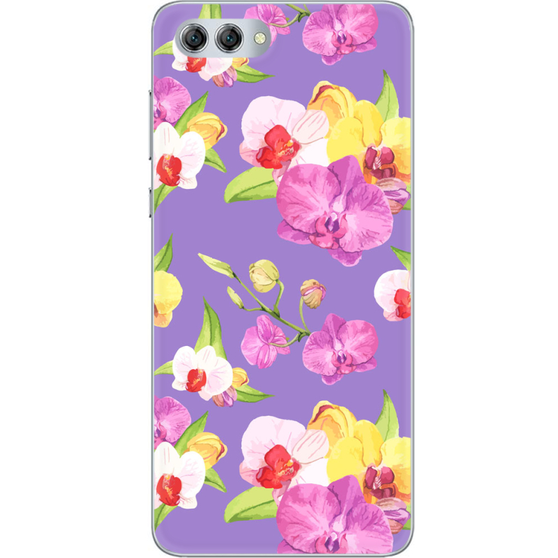 Чехол U-print Huawei Nova 2s 