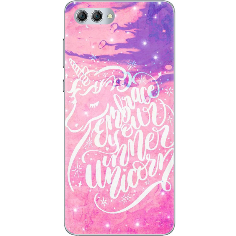 Чехол U-print Huawei Nova 2s 