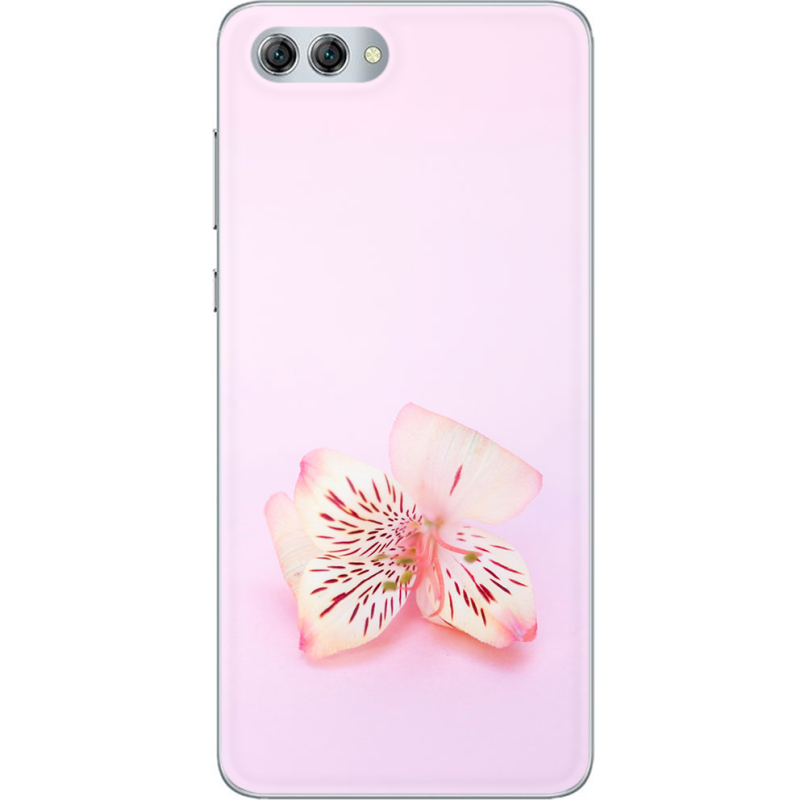 Чехол U-print Huawei Nova 2s 