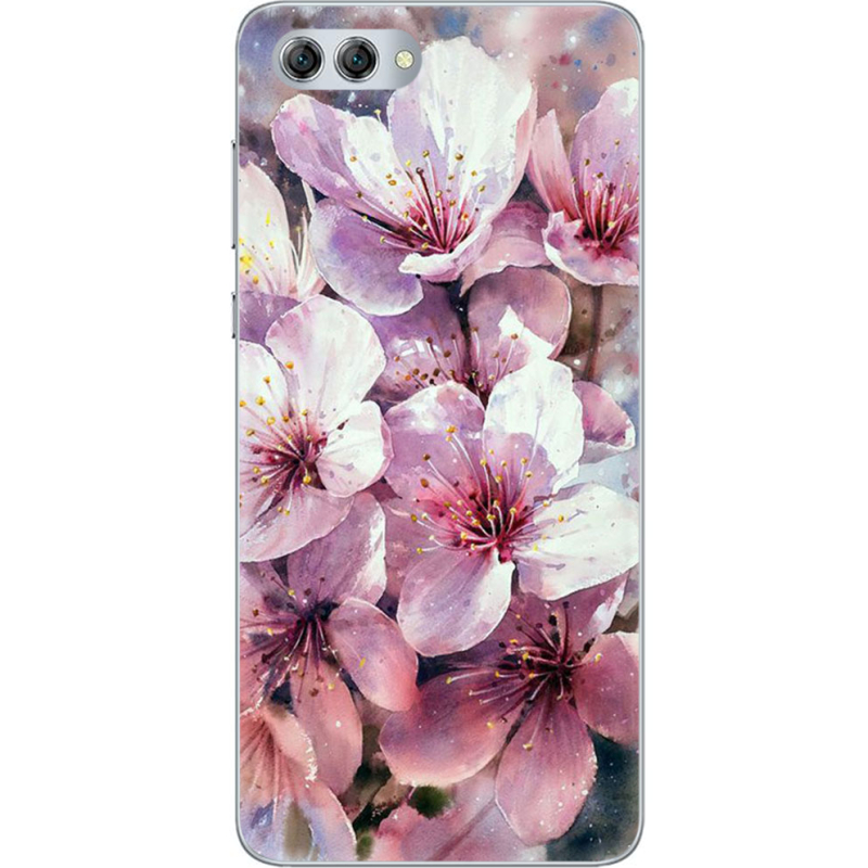 Чехол U-print Huawei Nova 2s 