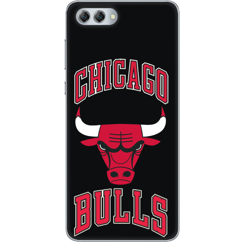 Чехол U-print Huawei Nova 2s 