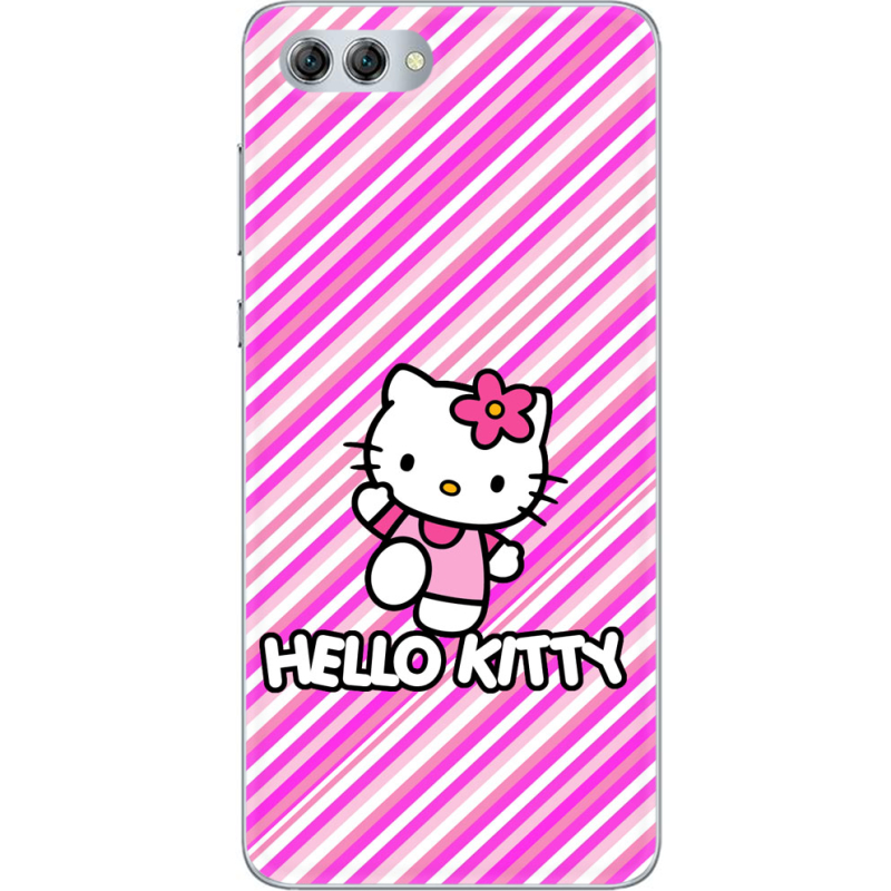 Чехол U-print Huawei Nova 2s 