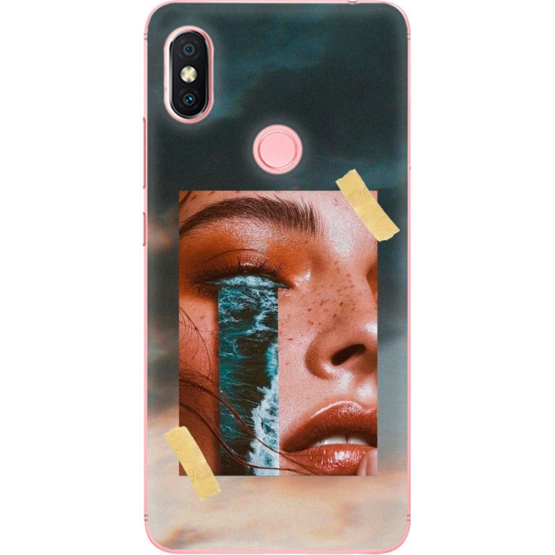 Чехол U-print Xiaomi Redmi S2 