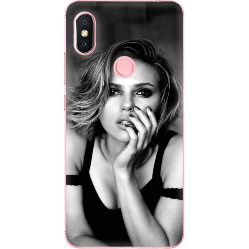 Чехол U-print Xiaomi Redmi S2 