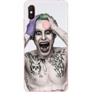 Чехол U-print Xiaomi Redmi S2 