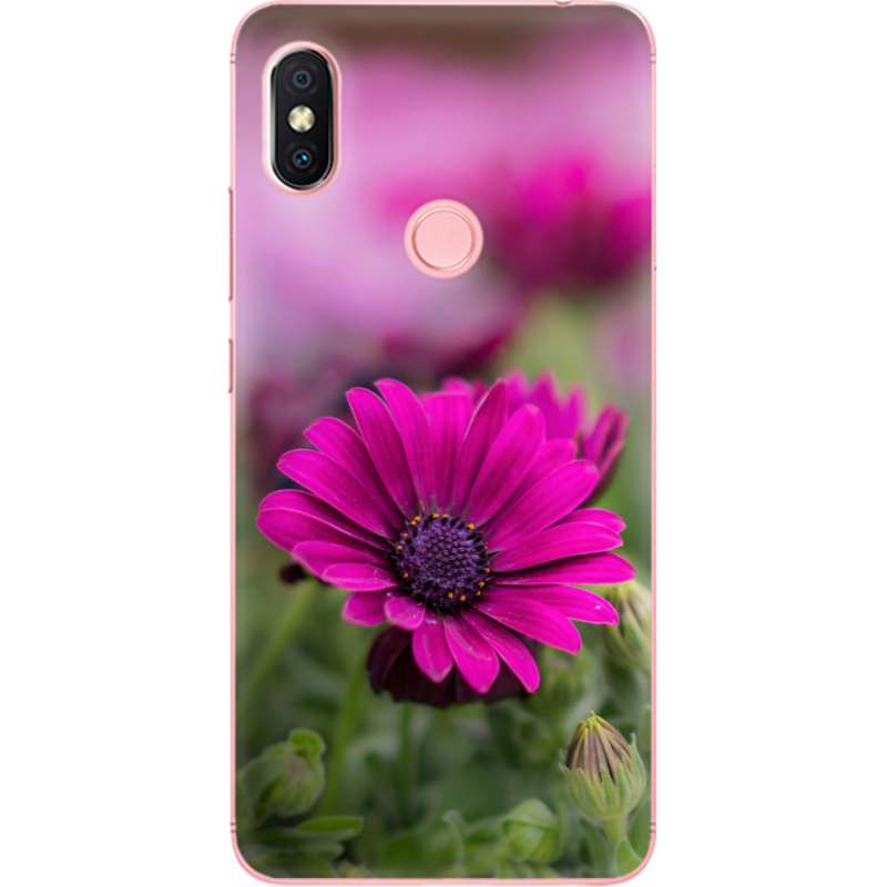 Чехол U-print Xiaomi Redmi S2 