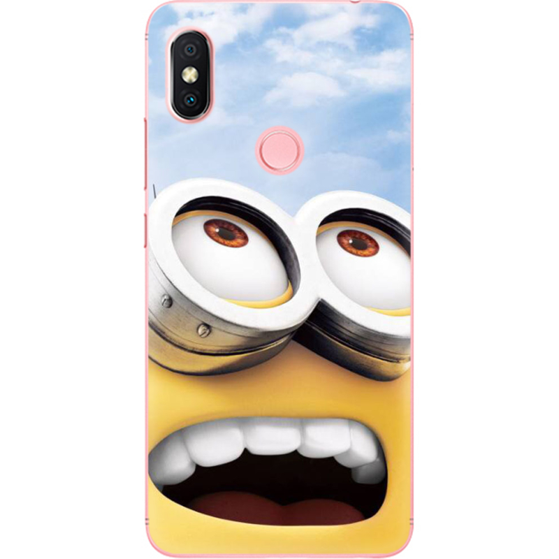 Чехол U-print Xiaomi Redmi S2 