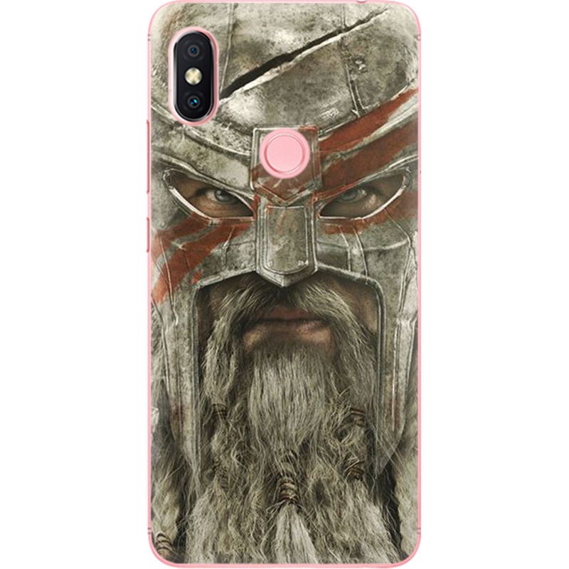 Чехол U-print Xiaomi Redmi S2 