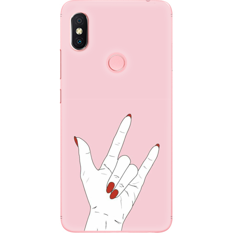 Чехол U-print Xiaomi Redmi S2 