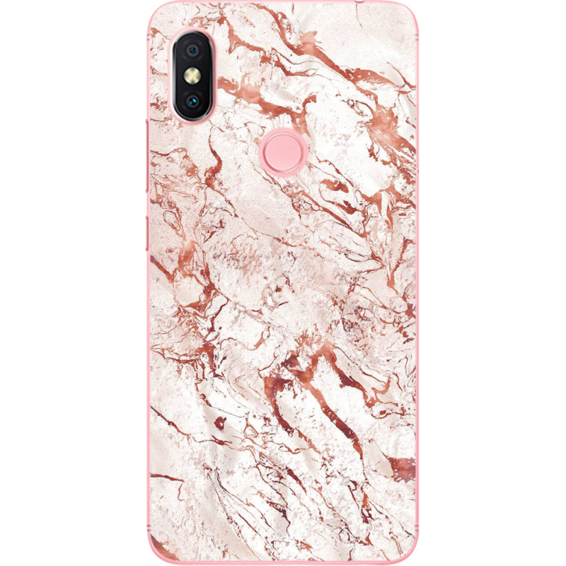 Чехол U-print Xiaomi Redmi S2 