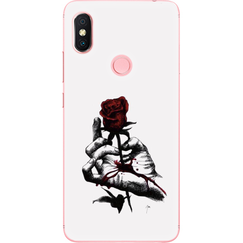 Чехол U-print Xiaomi Redmi S2 