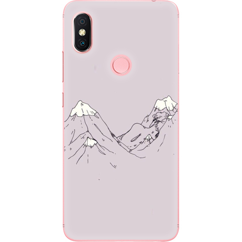 Чехол U-print Xiaomi Redmi S2 