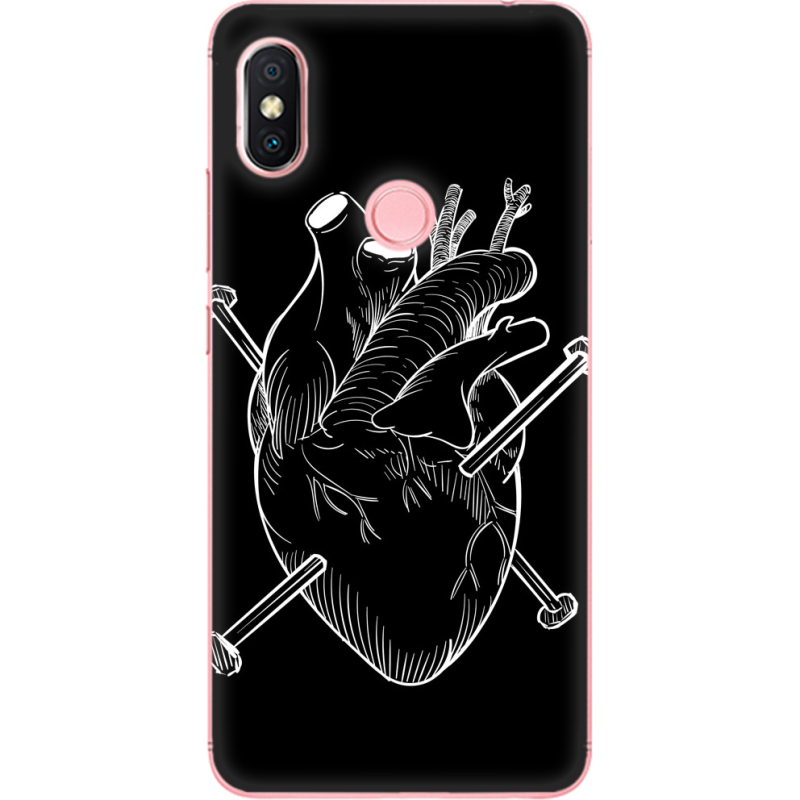 Чехол U-print Xiaomi Redmi S2 