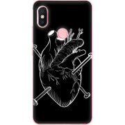 Чехол U-print Xiaomi Redmi S2 