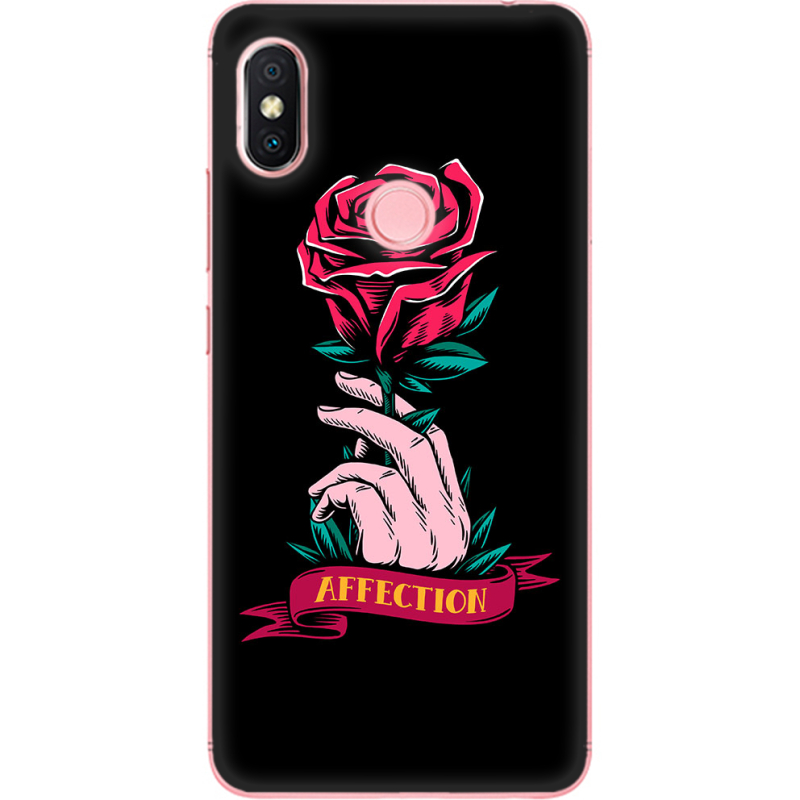 Чехол U-print Xiaomi Redmi S2 