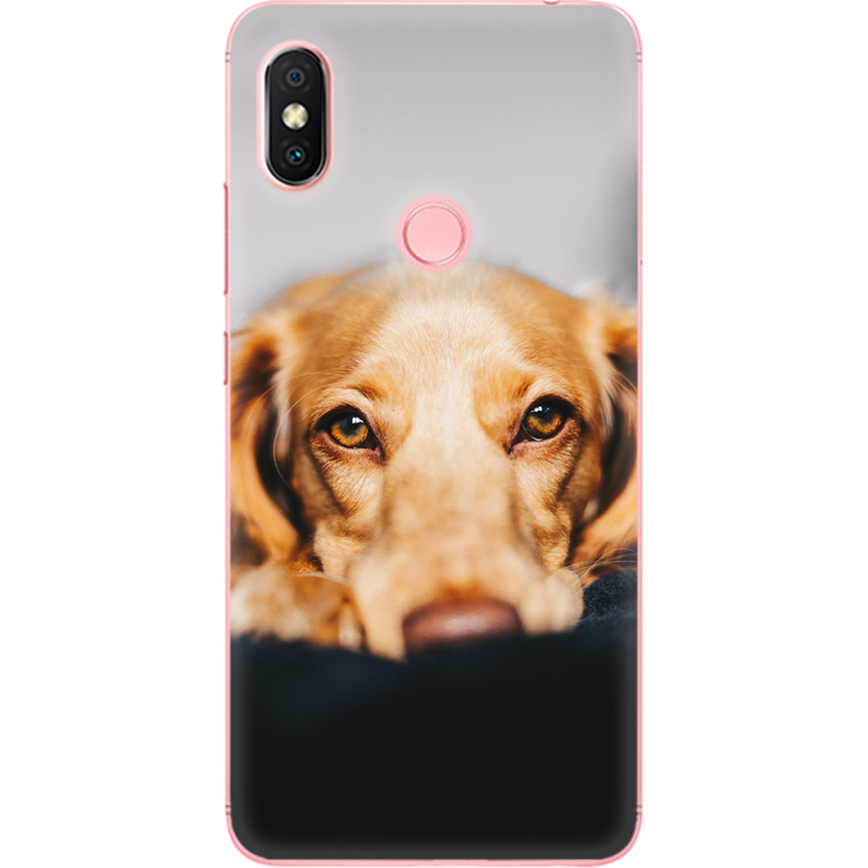 Чехол U-print Xiaomi Redmi S2 
