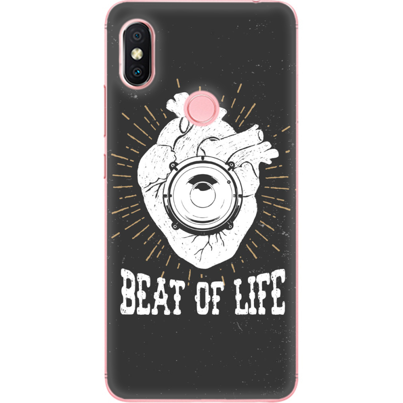 Чехол U-print Xiaomi Redmi S2 