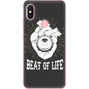 Чехол U-print Xiaomi Redmi S2 