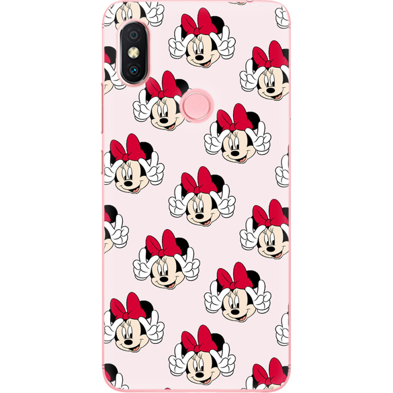 Чехол U-print Xiaomi Redmi S2 