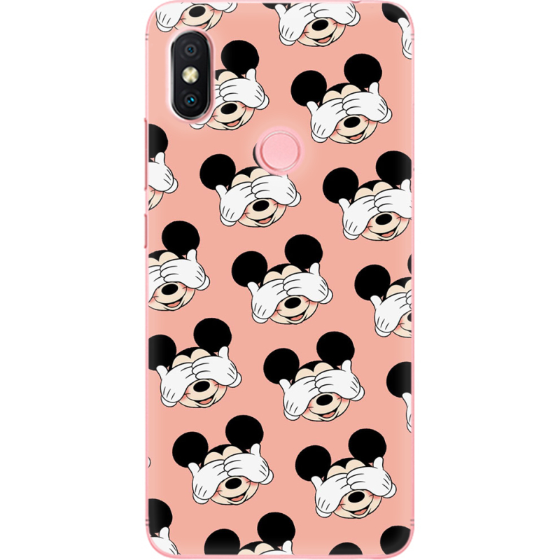 Чехол U-print Xiaomi Redmi S2 