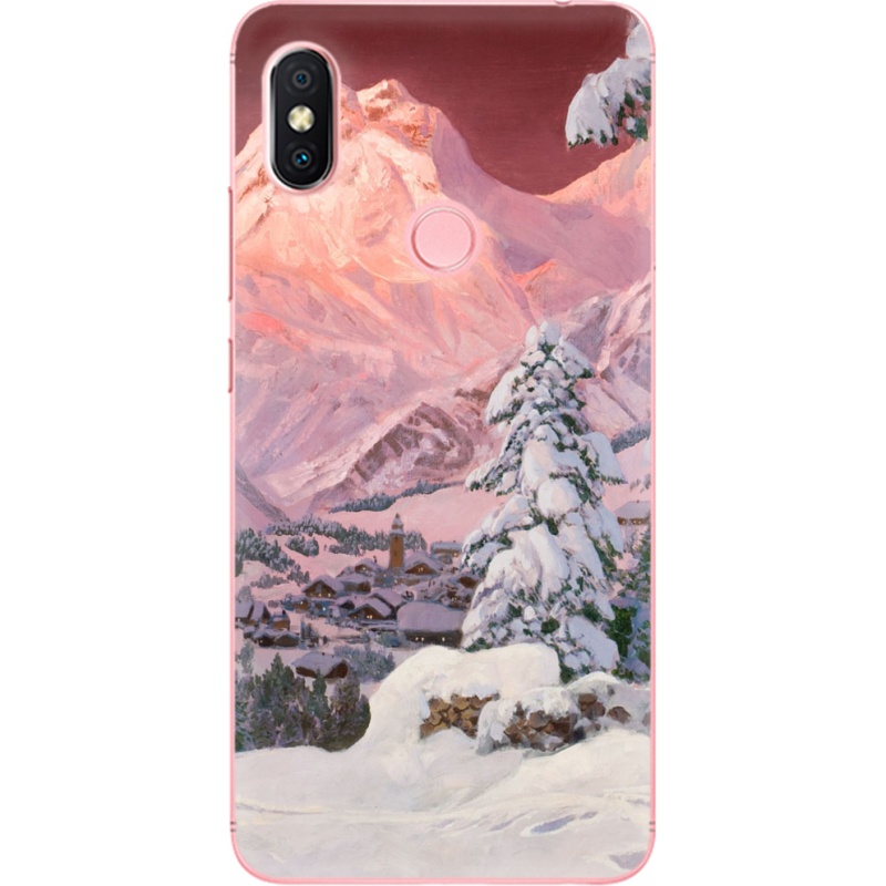 Чехол U-print Xiaomi Redmi S2 