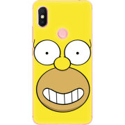 Чехол U-print Xiaomi Redmi S2 