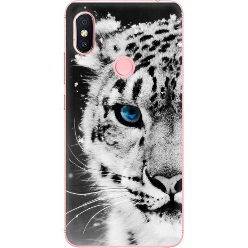 Чехол U-print Xiaomi Redmi S2 