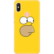 Чехол U-print Xiaomi Redmi S2 