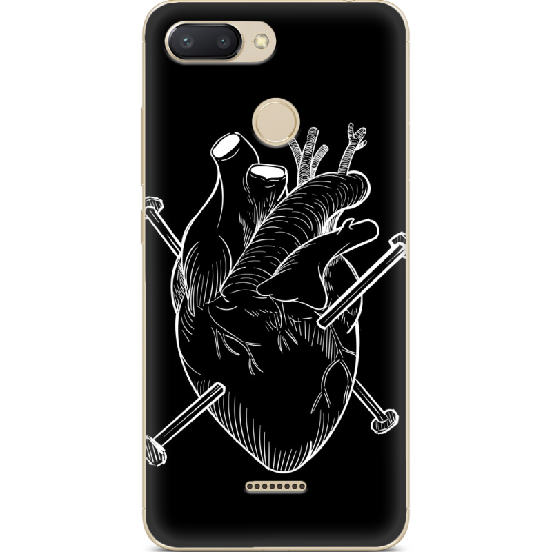 Чехол U-print Xiaomi Redmi 6 