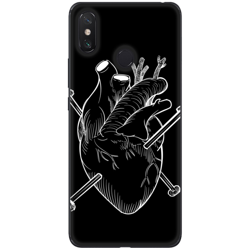 Чехол U-print Xiaomi Mi Max 3 