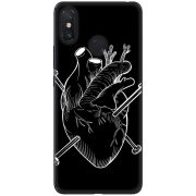 Чехол U-print Xiaomi Mi Max 3 