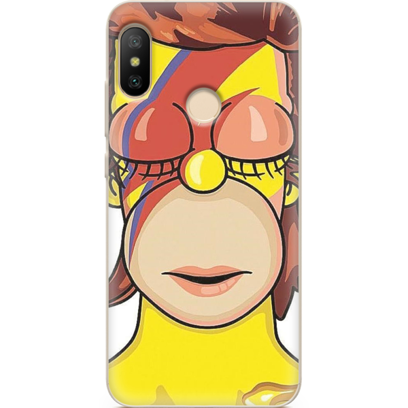 Чехол U-print Xiaomi Mi A2 Lite 